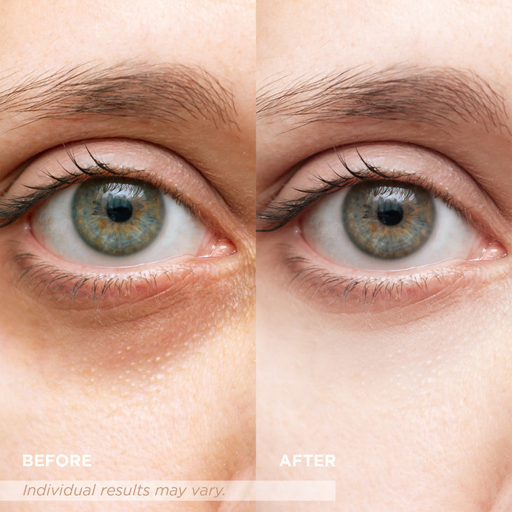 Under Eye Corrector SPF 41